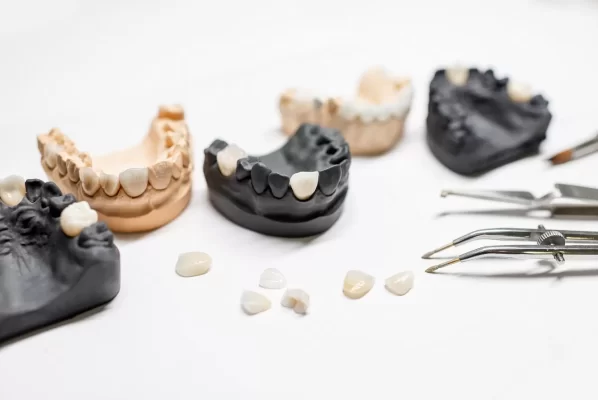 Artificial plaster jaw models with implants, veneers and dental instruments on the white background. Concept of aesthetic dentistry and implantation technology